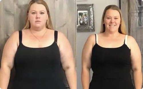 Before/after: Lauren T. transformation with LipoVive